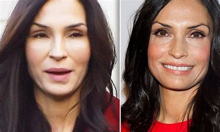 Famke Janssen Botox And Nose Job: Fans Suspect Plastic Surgery